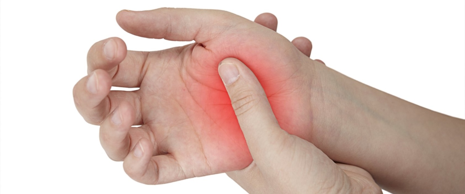 Carpal Tunnel Syndrome